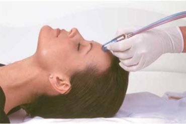 Q & A Microdermabrasion from A to Z