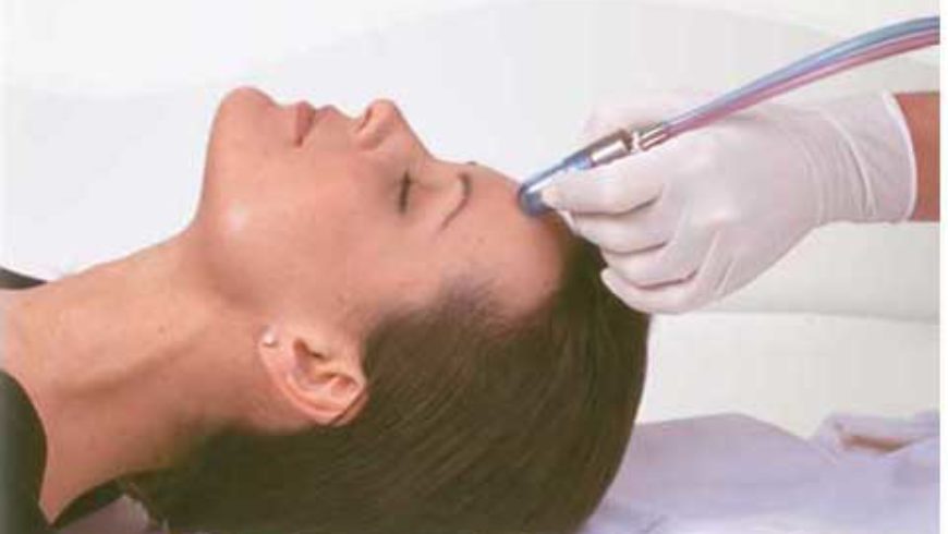 Q & A Microdermabrasion from A to Z